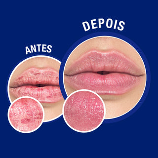 Neutrogena Bálsamo Reparação Intensa Nariz e Lábios Tubo 15ml