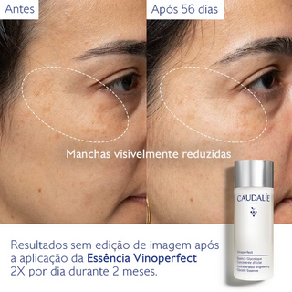 Caudalie Vinoperfect Essência Glicólica Concentrada Luminosidade 100ml