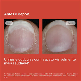Fortalecedor de uñas ISDIN Si-Nails 2,5 ml