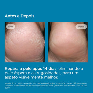 ISDIN Ureadin Podos Gel Oil 75 ml
