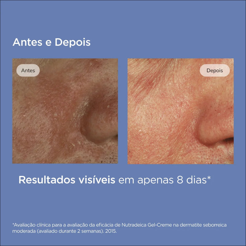 ISDIN Nutradeica Gel-Crema Facial