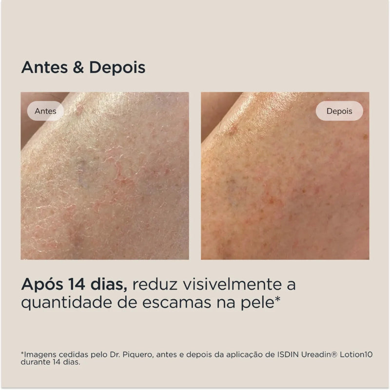 Isdin Hidratación Ureadin Crema Calma 400ml